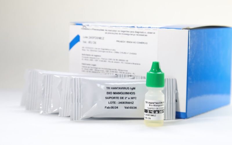 UFRJ e Fiocruz desenvolvem teste rápido para hantavirose